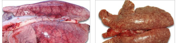 Lungs