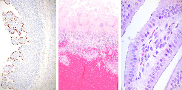 Rotavirus, E.coli and Clostridium perfringens