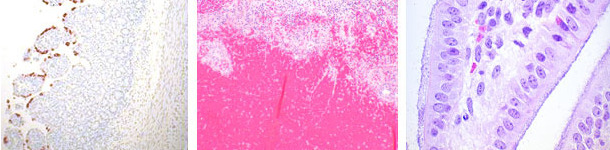 Rotavirus, E.coli and Clostridium perfringens