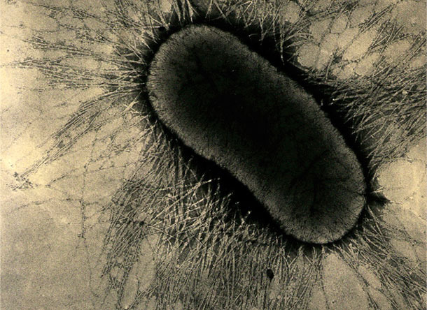 E coli fimbrial or pilus proteins, which firmly attach to enterocyte glycoprotein receptors on the intestinal cells