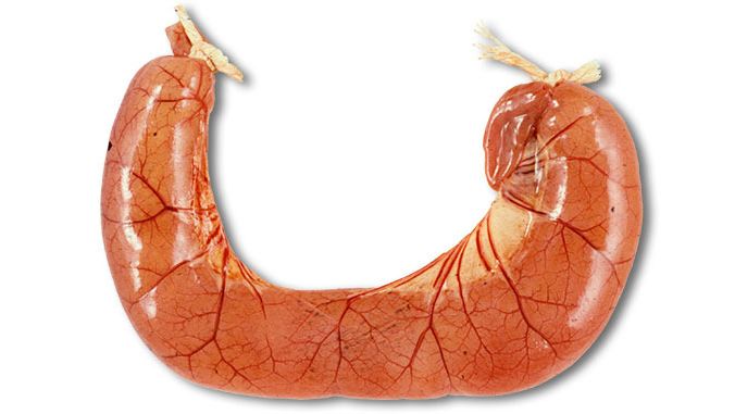 The autopsy of ETEC diarrhoea cases usually shows dilated, congested thin small intestine loops filled with the watery yellow diarrhoea