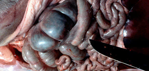 Showing fibrin peritoneal tags typical of acute App