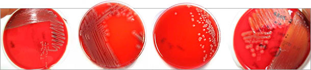 Different colony morphologies of pathogenic E. coli isolates