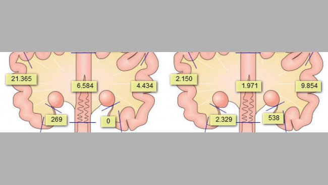 Presence of sperm cells in the genital tract of sows after 2 inseminations