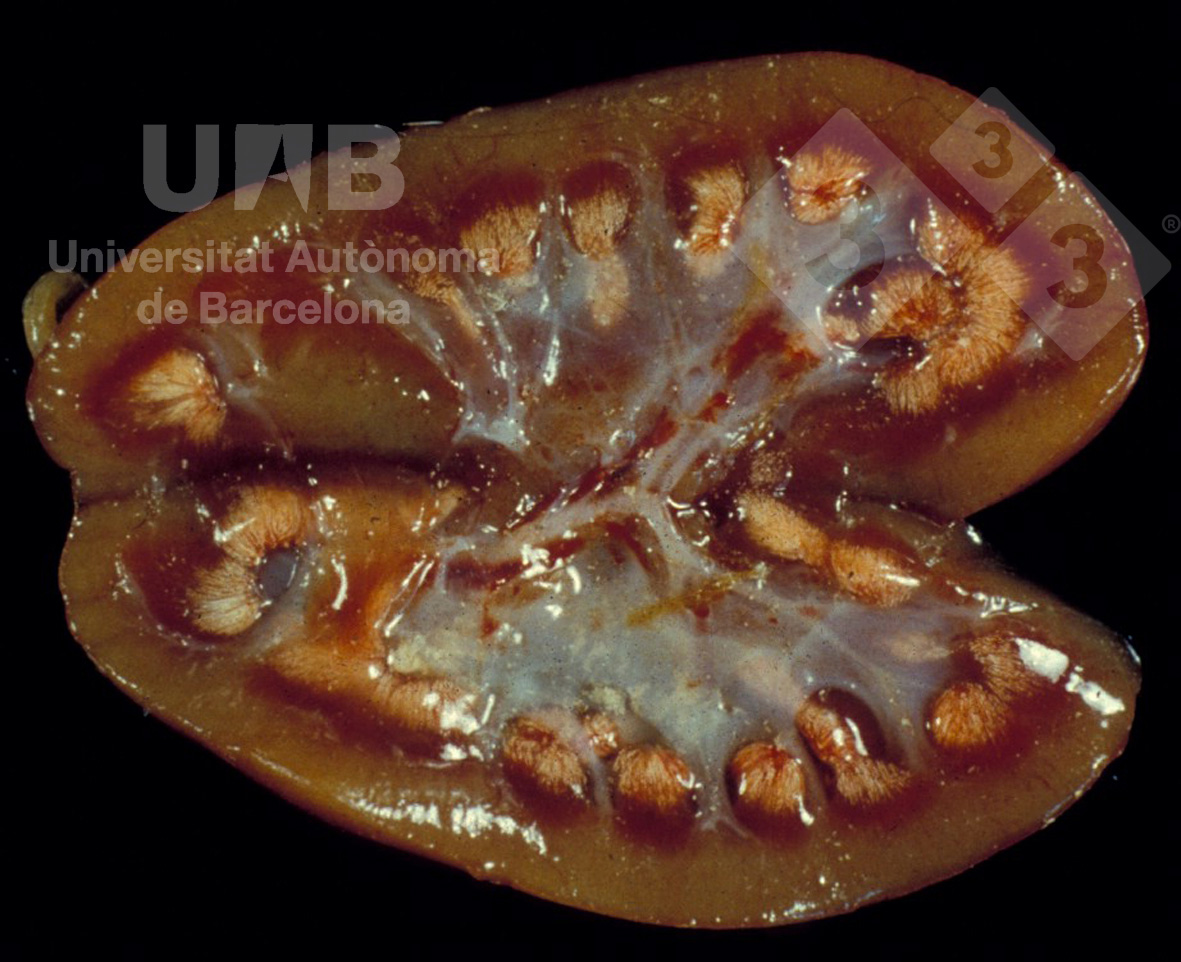 Renal papillary necrosis - Atlas of swine pathology - pig333, pig to