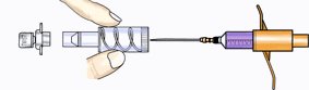 Stericap, Sterimatic needle protection system 10 ud. (4) Stericap, Sterimatic needle protection system 10 ud. (4)