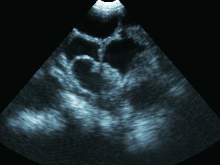Ultrasound - Backfat MSU3 3,5 MHz (9) Ultrasound - Backfat MSU3 3,5 MHz (9)