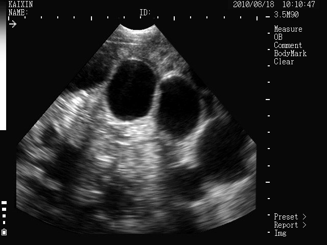 Ultrasound MSU1 Plus 3,5 MHz (8) Ultrasound MSU1 Plus 3,5 MHz (8)
