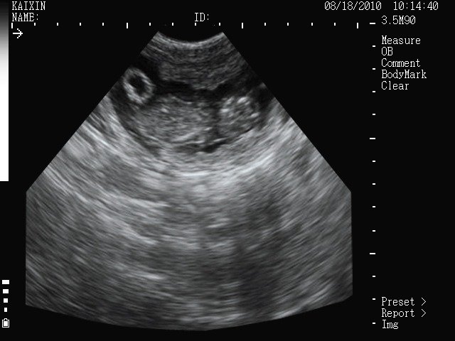 Ultrasound MSU1 Plus 3,5 MHz (9) Ultrasound MSU1 Plus 3,5 MHz (9)
