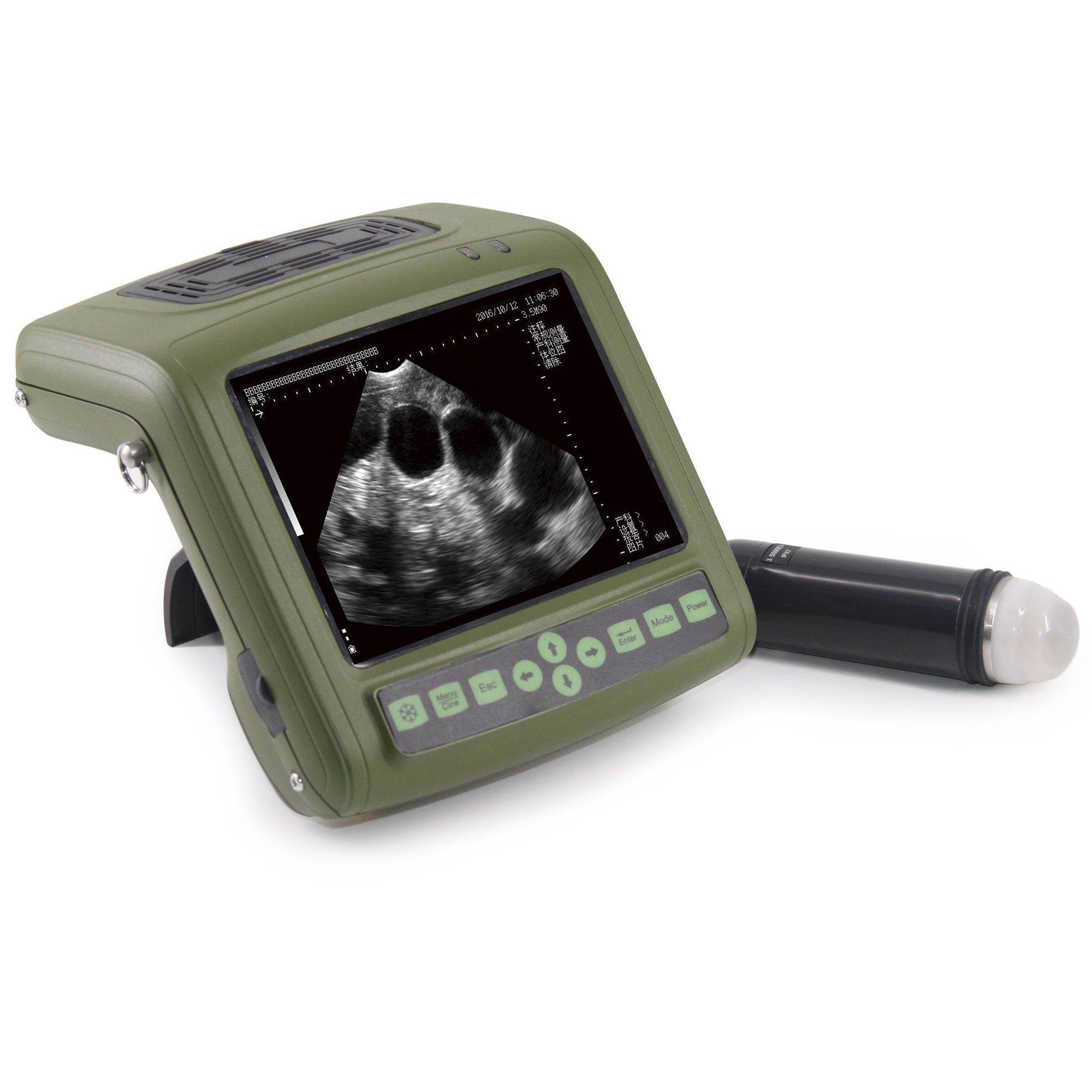 Ultrasound MSU1 Plus 3,5 MHz Ultrasound MSU1 Plus 3,5 MHz
