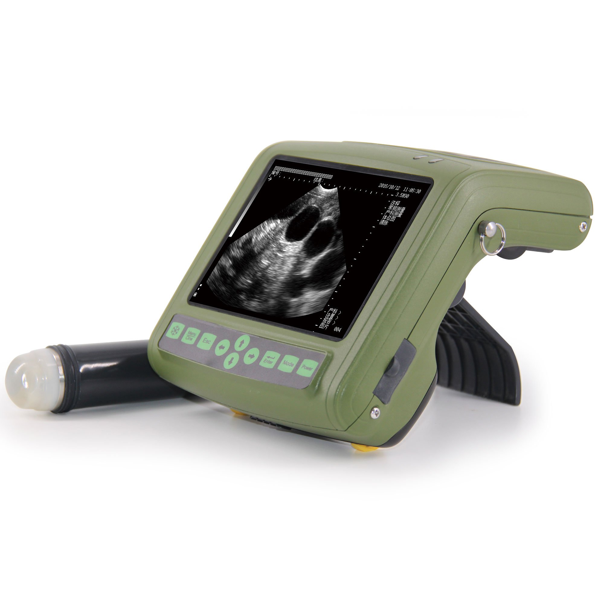 Ultrasound MSU1 Plus 3,5 MHz (5) Ultrasound MSU1 Plus 3,5 MHz (5)